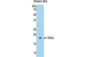 Detection of Recombinant NAGase, Mouse using Polyclonal Antibody to Meningioma Expressed Antigen 5 (MGEA5) (MGEA5 antibody  (AA 83-222))