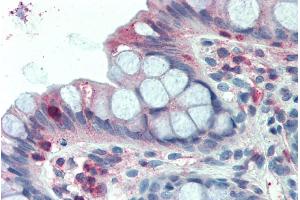 ABIN238605 (2. (LASP1 antibody  (Internal Region))