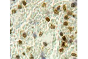 Used in DAB staining on fromalin fixed paraffin-embedded Spleen tissue (HPSE antibody  (AA 400-543))