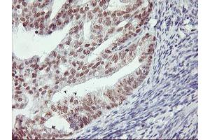 Image no. 3 for anti-Ring Finger Protein 113B (RNF113B) antibody (ABIN1500718) (RNF113B antibody)