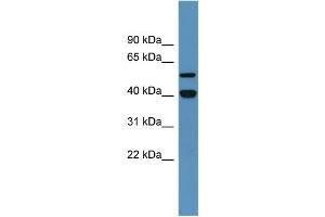 Western Blotting (WB) image for anti-Damage-Specific DNA Binding Protein 2, 48kDa (DDB2) (C-Term) antibody (ABIN617272) (DDB2 antibody  (C-Term))