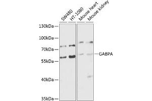 Western blot analysis of extracts of various cell lines, using GABPA antibody (ABIN6127940, ABIN6140889, ABIN6140892 and ABIN6224475) at 1:1000 dilution. (GABPA antibody  (AA 1-260))
