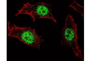 Fluorescent confocal image of HeLa cells stained with (ABIN389189 and ABIN2839352) KLF4 antibody. (KLF4 antibody)