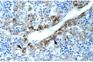 Human Liver; SLC30A9 antibody - N-terminal region in Human Liver cells using Immunohistochemistry (SLC30A9 antibody  (N-Term))