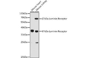 Western blot analysis of extracts of various cell lines, using 67 kDa Laminin Receptor antibody (ABIN6128199, ABIN6147247, ABIN6147248 and ABIN6224857) at 1:3000 dilution. (RPSA/Laminin Receptor antibody  (AA 1-295))
