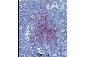 Formalin-fixed and paraffin-embedded human Thymus tissue reacted with SENP1 Antibody (N-term), which was peroxidase-conjugated to the secondary antibody, followed by AEC staining. (SENP1 antibody  (N-Term))