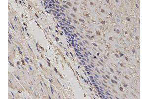 Immunohistochemistry (IHC) image for anti-Growth Arrest and DNA-Damage-Inducible, alpha (GADD45A) antibody (ABIN1872770)