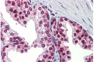 Immunohistochemistry (Paraffin-embedded Sections) (IHC (p)) image for anti-Ubiquilin 1 (UBQLN1) (AA 290-339) antibody (ABIN6741620)
