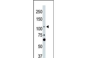 Western Blotting (WB) image for anti-LATS, Large Tumor Suppressor, Homolog 2 (Drosophila) (LATS2) (AA 228-258) antibody (ABIN5536845)