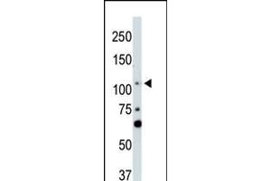 Antibody is used in Western blot to detect LATS2 in NIH-3T3 cell lysate. (LATS2 antibody  (AA 228-258))