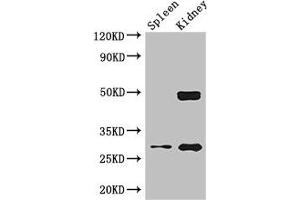 Western Blot Positive WB detected in: Mouse lung tissue, Mouse kidney tissue All lanes: DDAH2 antibody at 2. (DDAH2 antibody  (AA 1-285))