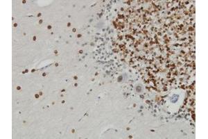 Image no. 2 for anti-Nucleoprotein TPR (TPR) (AA 1-99) antibody (ABIN598986) (TPR antibody  (AA 1-99))