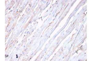 Formalin-fixed, paraffin-embedded human heart stained with N-Cadherin Recombinant Rabbit Monoclonal Antibody (CDH2/3874R). (Recombinant N-Cadherin antibody)