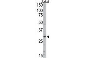 Western Blotting (WB) image for anti-Sirtuin 5 (SIRT5) antibody (ABIN3002566) (SIRT5 antibody)