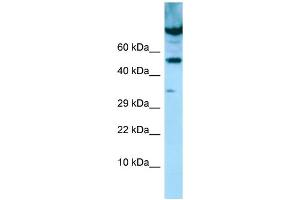 WB Suggested Anti-PDE7A Antibody Titration: 1. (PDE7A antibody  (C-Term))