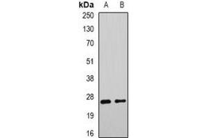 Western blot analysis of DNAJB9 expression in mouse liver (A), rat liver (B) whole cell lysates. (DNAJB9 antibody)