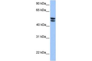 Western Blotting (WB) image for anti-3-Oxoacid CoA Transferase 1 (OXCT1) antibody (ABIN2463188) (OXCT1 antibody)
