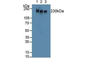 Western blot analysis of (1) Mouse Skeletal Muscle Tissue, (2) Rat Skeletal Muscle Tissue and (3) Mouse Heart Tissue. (MYH2 antibody  (AA 1238-1472))