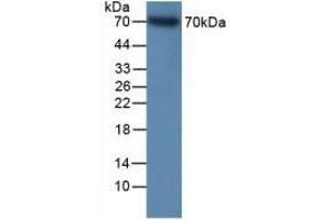 Detection of Recombinant ITGb2, Human using Polyclonal Antibody to Integrin Beta 2 (CD18) (Integrin beta 2 antibody  (AA 451-627))