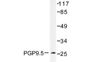 Image no. 2 for anti-Ubiquitin Carboxyl-terminal Esterase L1 (Ubiquitin Thiolesterase) (UCHL1) antibody (ABIN271784) (UCHL1 antibody)