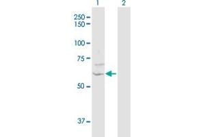 Western Blot analysis of ZNF238 expression in transfected 293T cell line by ZNF238 MaxPab polyclonal antibody. (ZNF238 antibody  (AA 1-522))