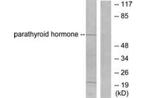 Western blot analysis of extracts from A549 cells, using Parathyroid Hormone Antibody. (PTH antibody  (AA 51-100))