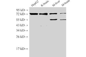 Western Blot analysis of 1)HepG2, 2)Rat brain, 3)Mouse liver, 4)Mouse brain using CD146 Ployclonal Antibody at dilution of 1:500. (MCAM antibody)