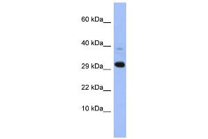 WB Suggested Anti-MRPL47 Antibody Titration: 0. (MRPL47 antibody  (Middle Region))