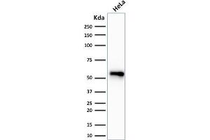 Western Blot Analysis of human HeLa cell lysate using Cytokeratin 7 Monoclonal Antibody (SPM270). (Cytokeratin 7 antibody)