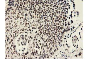 Image no. 2 for anti-General Transcription Factor IIF, Polypeptide 1, 74kDa (GTF2F1) antibody (ABIN1500597) (GTF2F1 antibody)