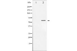 CHEK1 antibody  (pSer317)