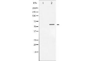 Western blot analysis of Chk1 phosphorylation expression in MCF7 whole cell lysates,The lane on the left is treated with the antigen-specific peptide. (CHEK1 antibody  (pSer317))