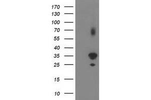 Western Blotting (WB) image for anti-Pleckstrin Homology Domain Containing Family A3 (PLEKHA3) antibody (ABIN1500273)