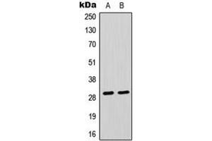 Western blot analysis of CLIC4 expression in Raji (A), HeLa (B) whole cell lysates. (CLIC4 antibody  (N-Term))