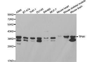 Western blot analysis of extracts of various cell lines, using TPM1 antibody (ABIN2989338) at 1/1000 dilution.