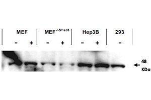 Western blot using SMAD3 polyclonal antibody  shows detection of endogenous SMAD3 in both unstimulated and stimulated cell lysates. (SMAD3 antibody  (AA 417-425))