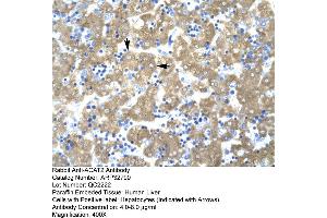 Human Liver (ACAT2 antibody  (Middle Region))