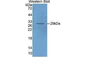 Western blot analysis of the recombinant protein. (CD25 antibody  (AA 22-243))
