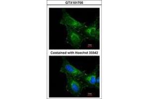 Image no. 3 for anti-Peroxiredoxin 1 (PRDX1) (AA 19-116) antibody (ABIN467365) (Peroxiredoxin 1 antibody  (AA 19-116))