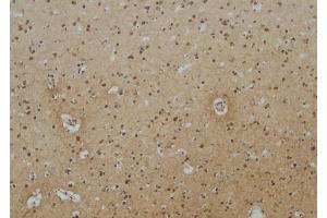 ABIN6257165 and ABIN6275114 at 1/100 staining Human brain tissue by IHC-P. (EPN3 antibody  (Internal Region))