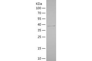 Western Blotting (WB) image for phospholipase A2, Group XIIA (PLA2G12A) (AA 24-189) protein (His-IF2DI Tag) (ABIN7124431) (PLA2G12A Protein (AA 24-189) (His-IF2DI Tag))