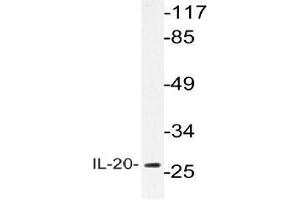 Western blot (WB) analysis of IL-20 antibody in extracts from A549 cells. (IL-20 antibody)