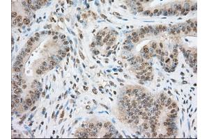 Image no. 8 for anti-Transforming, Acidic Coiled-Coil Containing Protein 3 (TACC3) antibody (ABIN1498099) (TACC3 antibody)