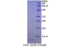 SDS-PAGE (SDS) image for Selenoprotein W, 1 (SEPW1) (AA 1-86) protein (His tag) (ABIN2122054)