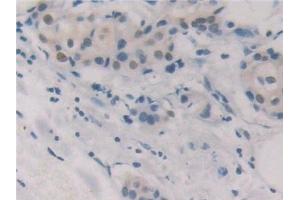 Immunohistochemistry (IHC) image for anti-Glutathione Reductase (GSR) (AA 44-522) antibody (ABIN7433438)