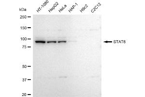 Western blotting analysis using STAT6 antibody (ABIN7800349).