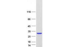 Western Blotting (WB) image for Parkinson Protein 7 (PARK7) (Transcript Variant 2) protein (Myc-DYKDDDDK Tag) (ABIN2719516)