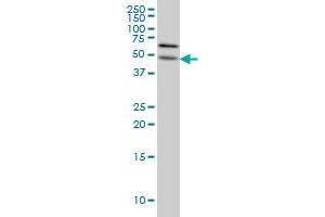 ALG12 monoclonal antibody (M06), clone 5E3 Western Blot analysis of ALG12 expression in HeLa . (ALG12 antibody  (AA 369-425))