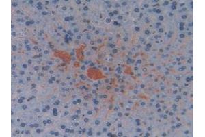 Immunohistochemistry (IHC) image for anti-Transcription Elongation Factor B (SIII), Polypeptide 3 (110kDa, Elongin A) (TCEB3) (AA 76-345) antibody (ABIN7442822)