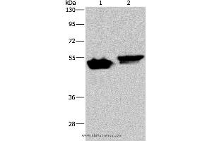 Western blot analysis of Raji and Hela cell, using AVEN Polyclonal Antibody at dilution of 1:200 (AVEN antibody)